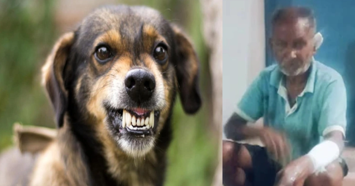 Stray Dog Attack में बुजुर्ग घायल, 15 मिनट तक नोचता रहा