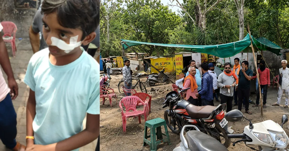Jabalpur में 9 साल के क्रिकेट खिलाड़ी पर हमला, गिलास फेंककर किया घायल