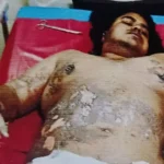 Madan Mahal Flyover हमले का खुलासा, युवक पर फेंका था ज्वलनशील पदार्थ