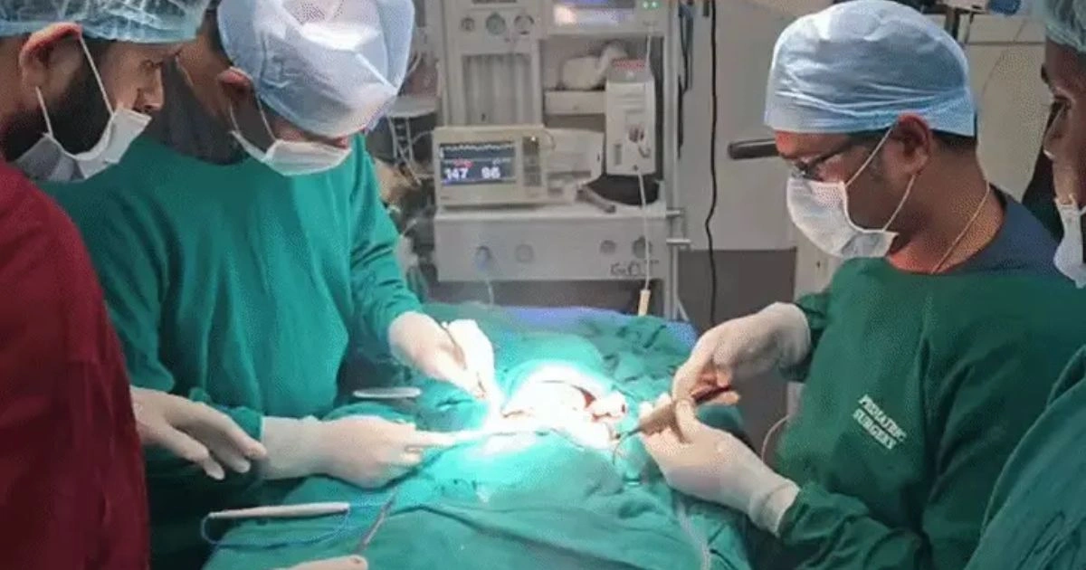 जबलपुर में पहली बार सफल कंजॉइंट ट्विन्स सर्जरी, दो घंटे के ऑपरेशन में अलग हुए दोनों मासूम